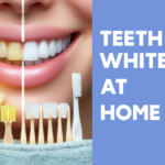Best Way to Whiten Teeth Fast : Teeth Whitening at Home